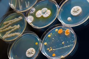 mikrobiyoloji testleri