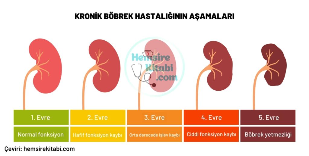 bobrek-yetmezligi-evreleri